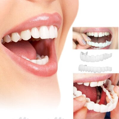 TerraHush™ Snap-On Veneers