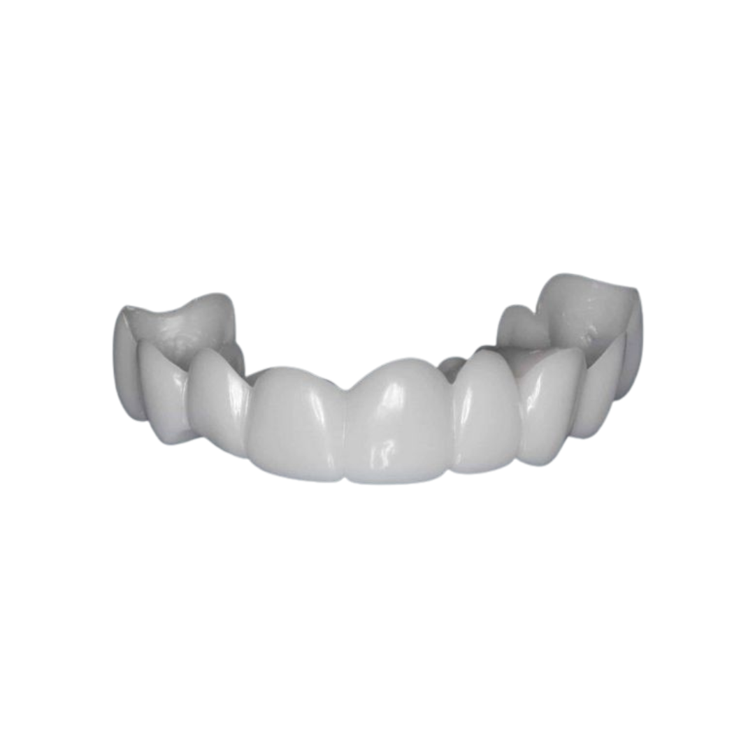 TerraHush™ Snap-On Veneers