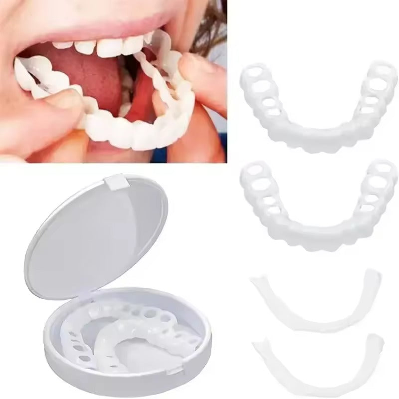 TerraHush™ Snap-On Veneers